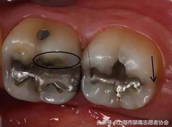 毒言毒语大全,一口烂牙你们郁闷吗