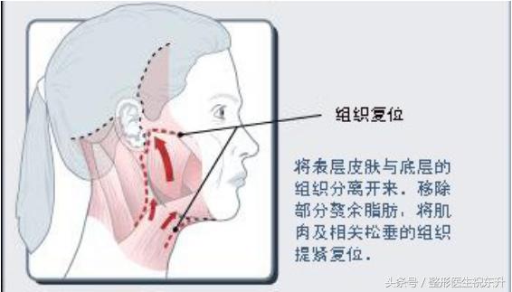 25岁脸皮肤松弛该怎么改善,脸皮肤松垮怎么补救