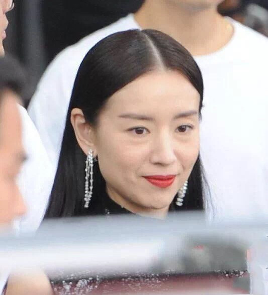 马东眼袋消除前后对比,马东去眼袋效果