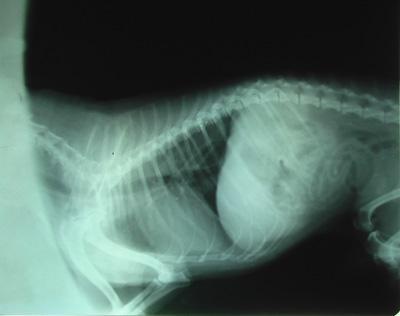 医院因为新冠造成误诊,医院误诊导致肺炎