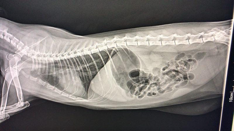 医院因为新冠造成误诊,医院误诊导致肺炎