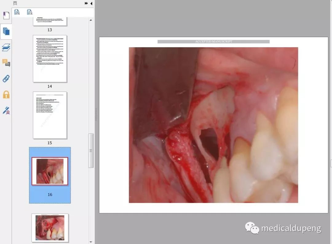 医学插画插图,医学插画sci