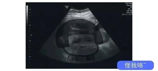 避孕套是一次性的，竟有人洗了反复用！