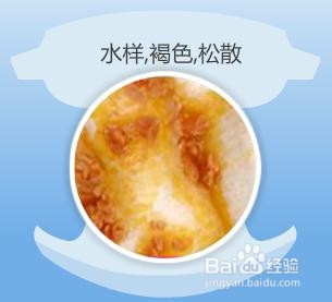 婴儿10-12个月粪便颜色,婴幼儿正常大便的颜色和性状