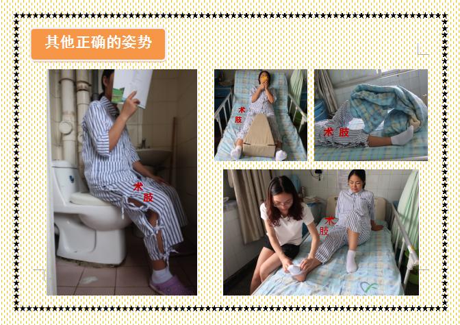 人工股骨头置换术术后教学查房,人工髋关节置换术后护理注意事项