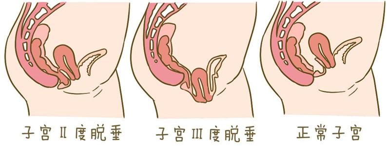羞于启齿六十七,羞于启齿101大结局