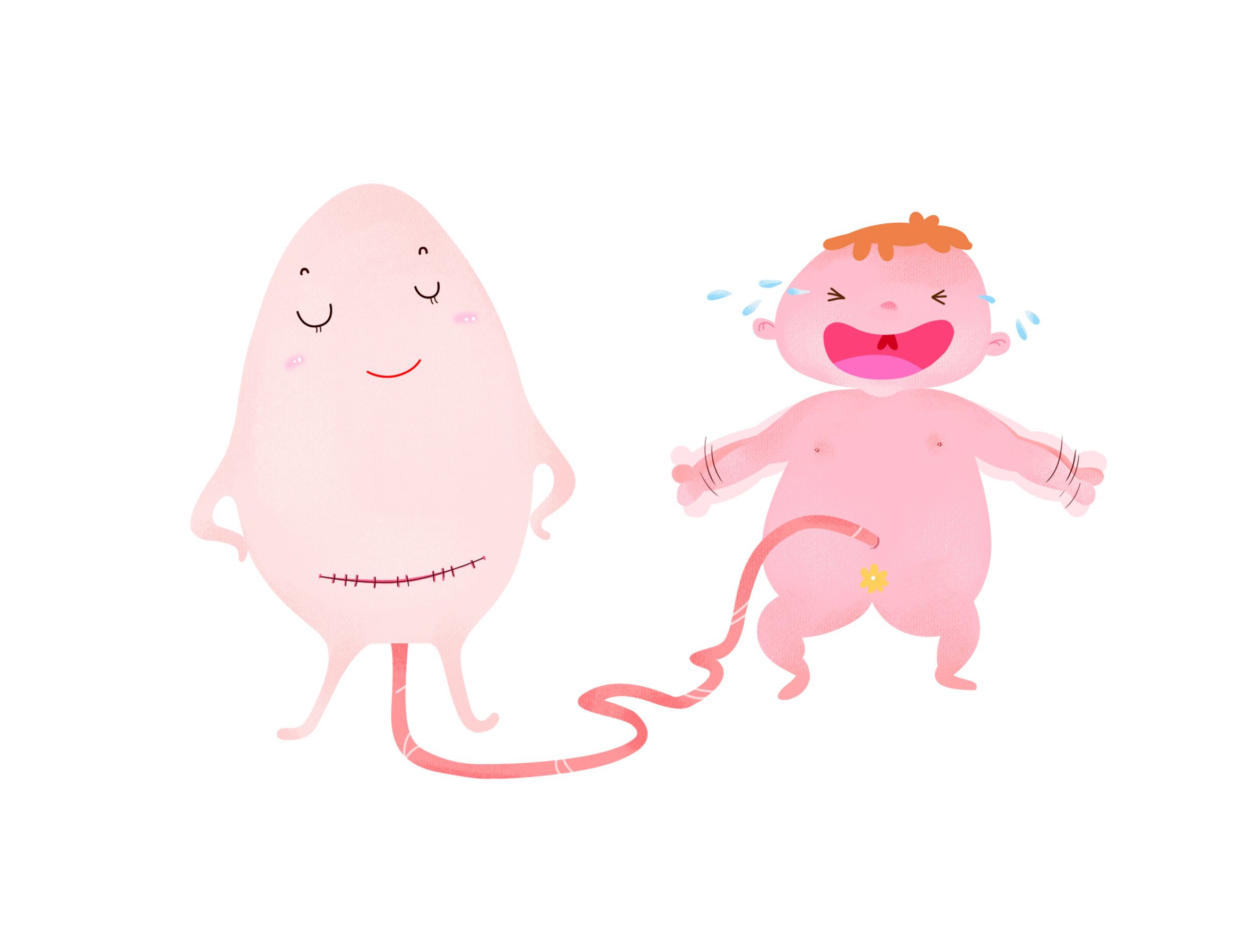 剖宫产科普漫画版,无痛分娩科普画