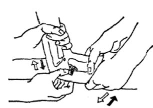中医骨折治疗原则,中医骨伤整复术