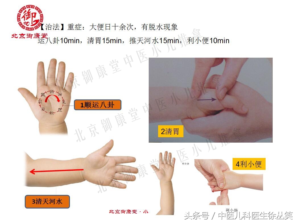 小儿腹泻中医按摩的方法,小儿秋季腹泻推拿常用手法