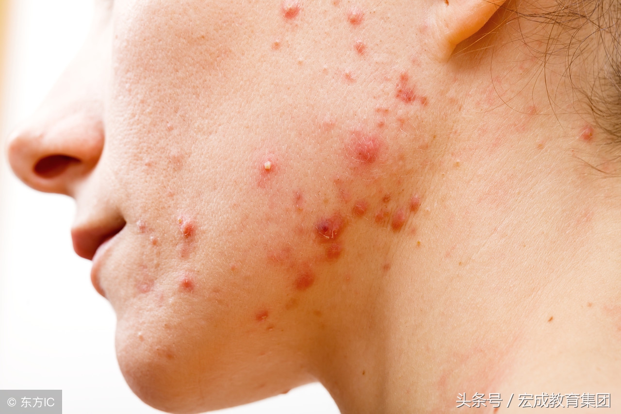 局限性神经功能障碍性皮肤病用药,常见的皮肤病用什么草药治疗