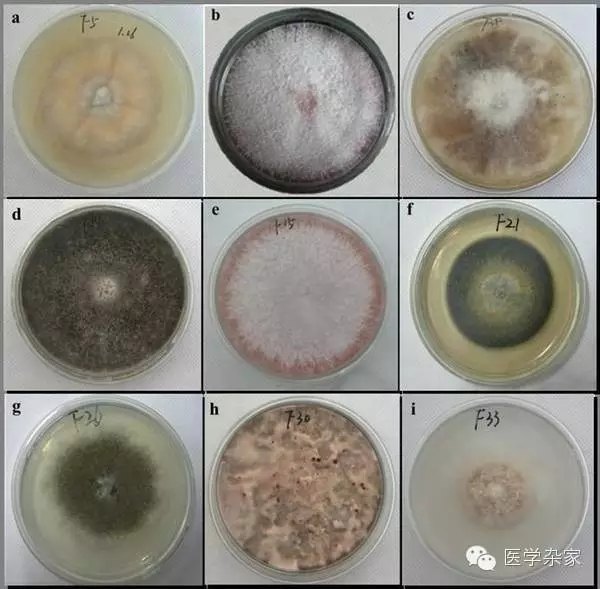 脚气为啥不会断根,为什么脚气断不了根