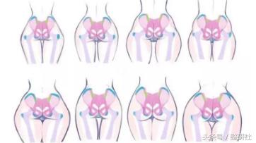 扁臀跟翘臀哪一种更好看,不要臀部翘让臀部变小