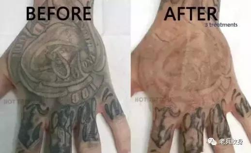 科普洗纹身的那些事儿,洗纹身误区以及洗纹身真实案例