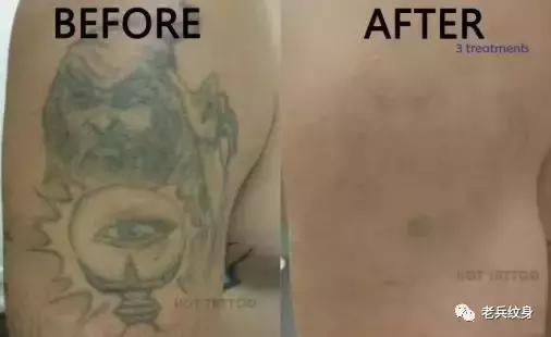 科普洗纹身的那些事儿,洗纹身误区以及洗纹身真实案例