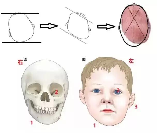 宝宝偏头斜头严重长大了会好吗,宝宝头偏脸歪有什么办法吗