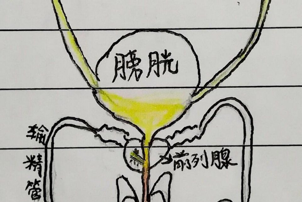 血尿的原因及诊疗,什么是血尿引起血尿的原因是什么