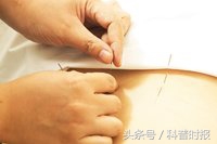 关于针灸的科普文章,祖传针灸真的能治病吗