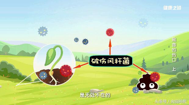 破伤风科普小知识,破伤风伤口最初症状