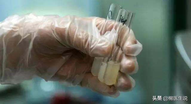 去医院检查精子前注意什么,去医院检查精子之前要准备什么