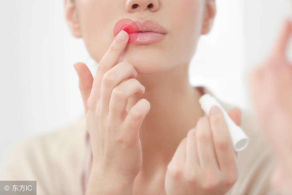 冬天嘴唇干燥怎么办用什么维生素,冬天皮肤干燥嘴唇干裂吃什么好