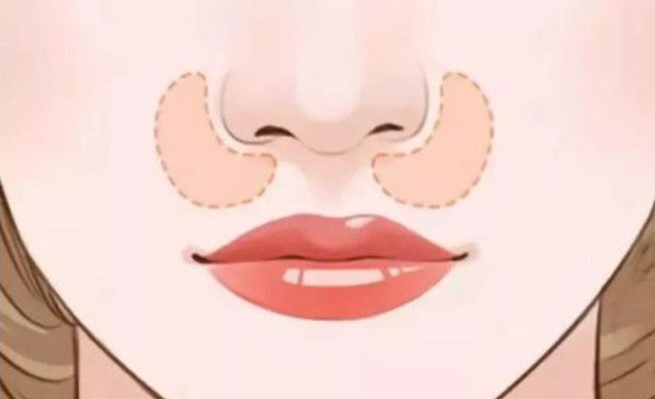 热玛吉法令纹消失了,热玛吉和fotona4d哪个法令纹效果好