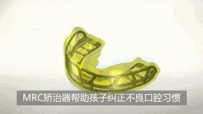 儿童mrc肌功能矫正费用,mrc肌功能矫正