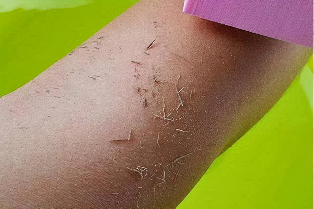 为啥要去脸部角质,为什么要去皮肤上的角质