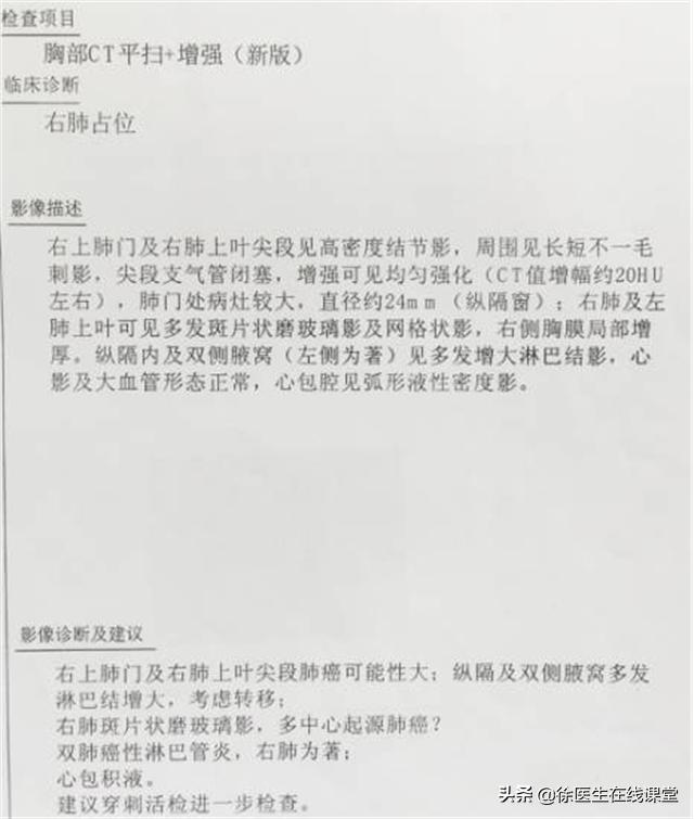 肾病综合征患者得肺癌怎么治疗,肾病综合征与肺癌患者