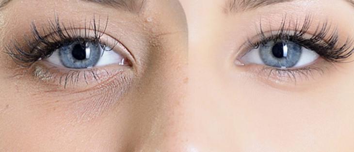 在人人爱美的时代，黑眼圈很重怎么办？缓解黑眼圈的有效办法推荐