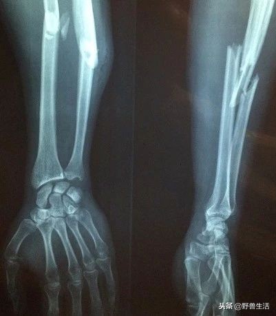 这4种维生素80%人非常缺,三秒判断出缺哪种维生素