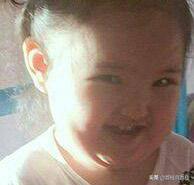 人中黑头挤完留下一个小坑,挤完黑头留下的洞洞怎么办