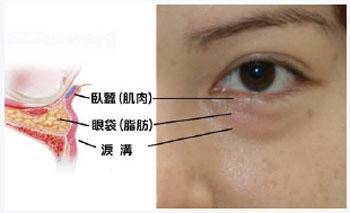 眼睛没有细纹需要眼膜吗,眼膜有用吗能去皱纹吗