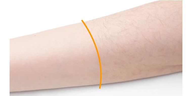 j-style冰点脱毛仪,j-style光子嫩肤脱毛仪