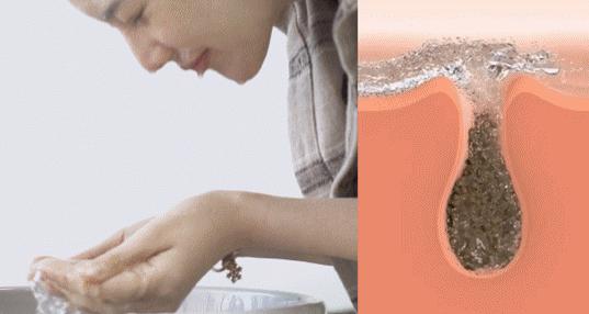 脸油痘痘多黑头用什么简单洗干净,清理黑头痘痘的最简单方法