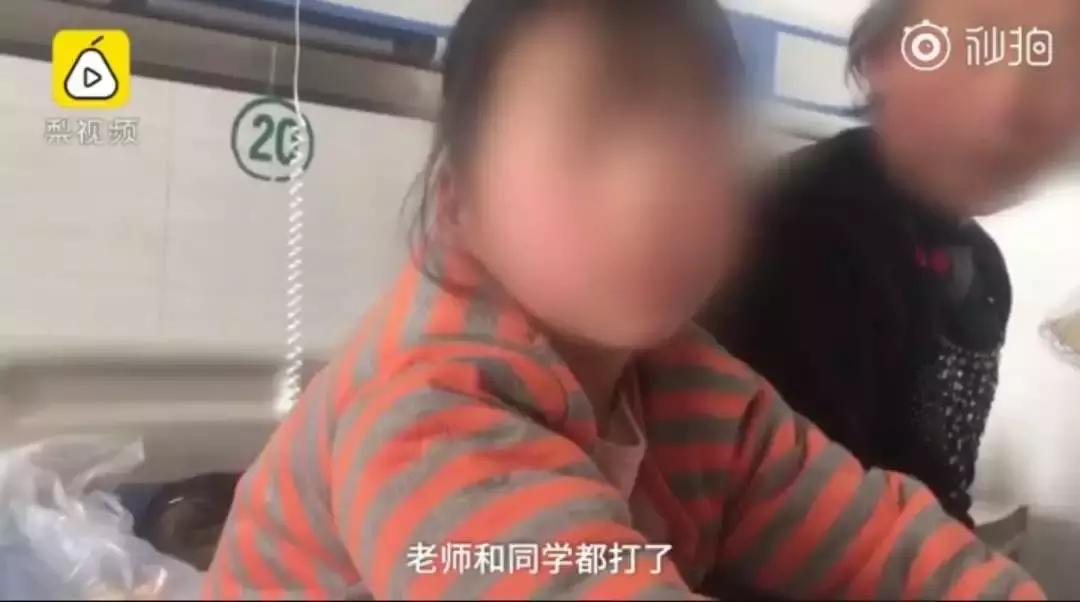 8岁女孩医疗事故身亡,8岁女童摔伤后续