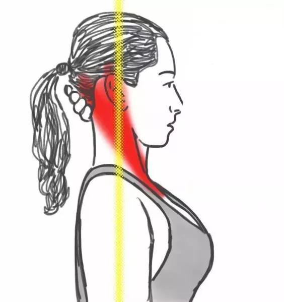 11岁孩子颈椎有个富贵包怎么办,每天10分钟消除颈椎富贵包