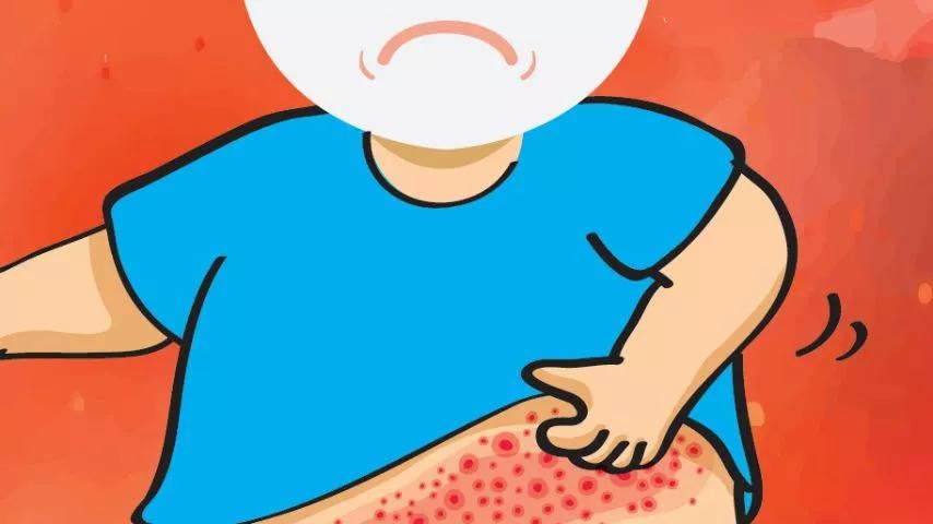 皮肤痒的软膏有哪些,治疗皮肤痒的药膏对照大全