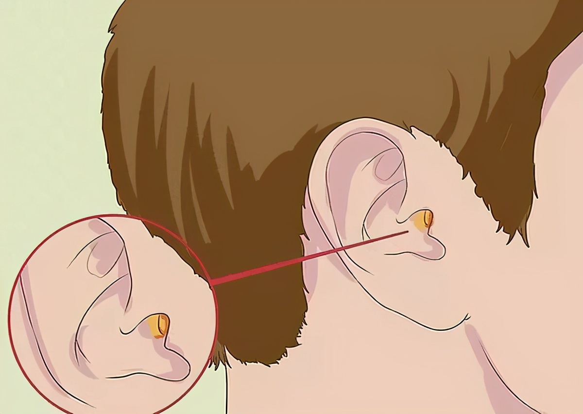 家长警惕！4岁小孩耳朵突然流脓，只因做了这一件小事