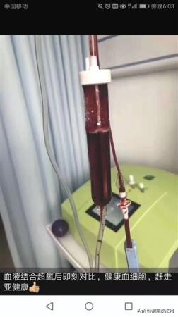 洗血疗法到底好不好,洗血美容有什么危害