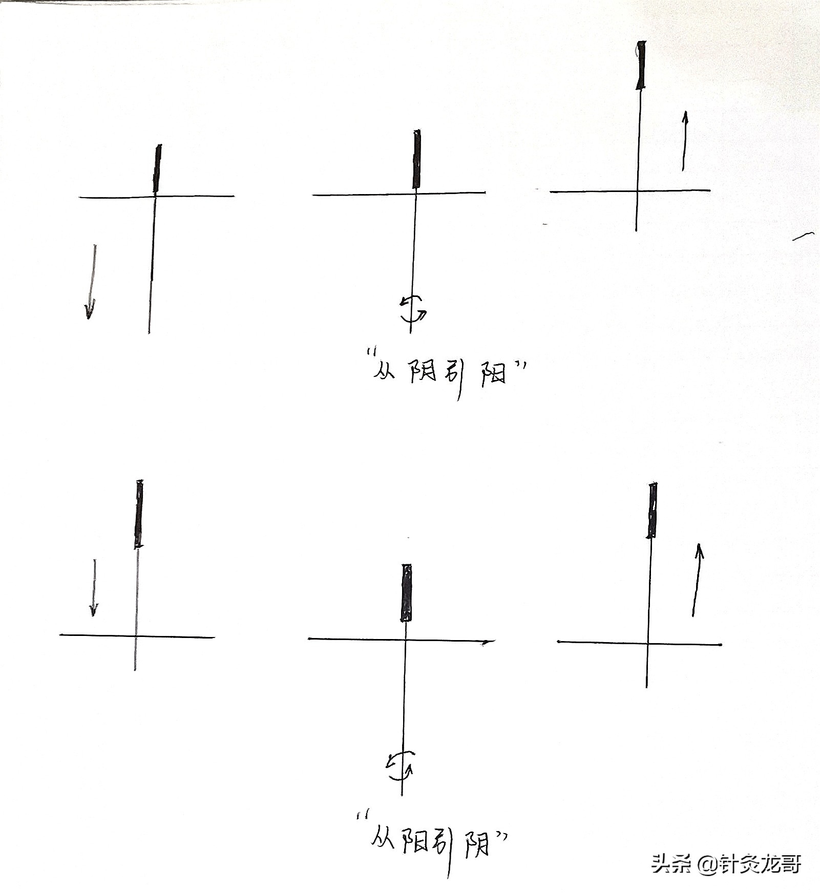 从阴引阳的针灸操作方法,引阳入阴针法