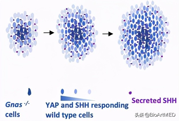 进展|哈佛华人教授团队揭示异位骨化形成及扩展的新机制​
