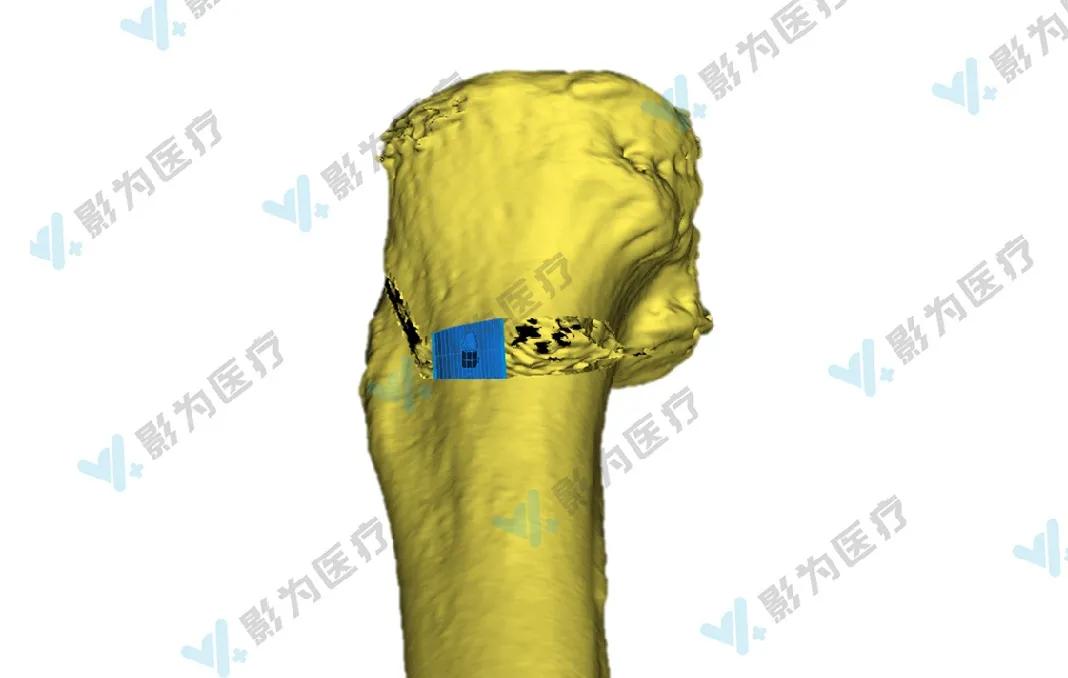 安医大阜阳附属医院减重,阜阳市颍州区安医大附属阜阳医院