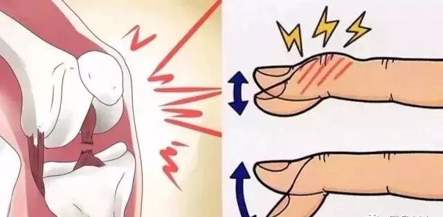 训练完关节响,训练时关节为什么会响