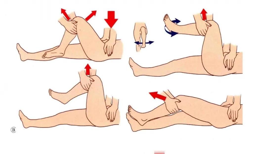 髋关节脱位闭合复位方法,髋关节脱位复位治疗过程