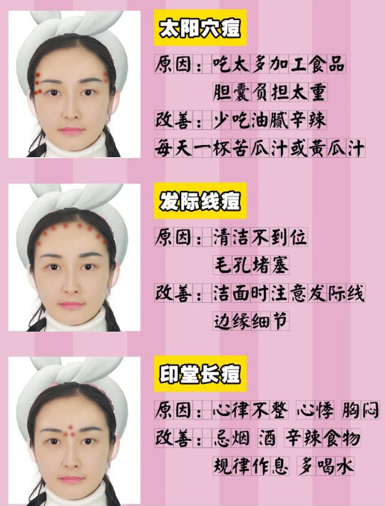 脸上各个位置长痘痘的原因是什么,脸上痘痘的种类及图片