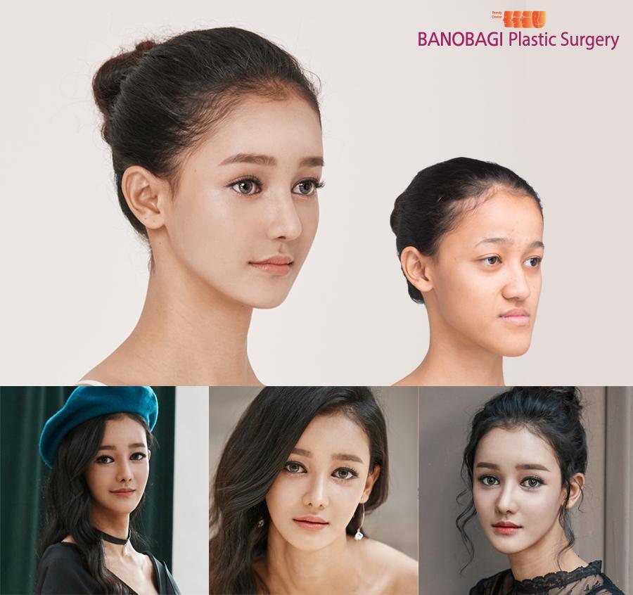 泰国最逆天的不是变性，而是堪比换头的整形