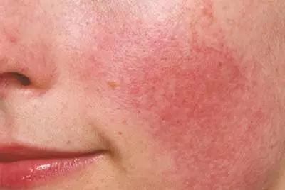 李佳琦没骗我!“国货之光”拯救烂脸,销量21万,乔欣都爱上了