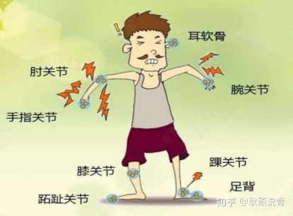 大脚趾痛风怎么治最快最有效,大脚趾痛风注意什么