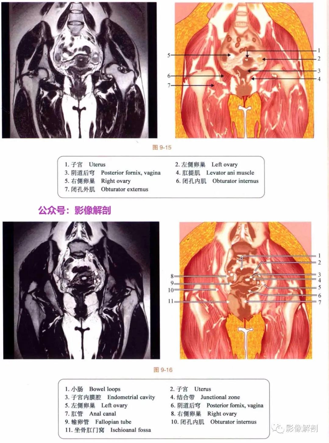 女性盆腔矢状位断层解剖,男性盆腔磁共振断层图谱