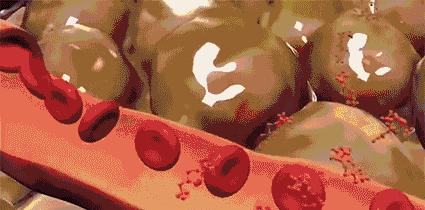 如何一天瘦腿之吴昕瘦腿法,吴昕瘦腿成功靠的是打瘦腿针